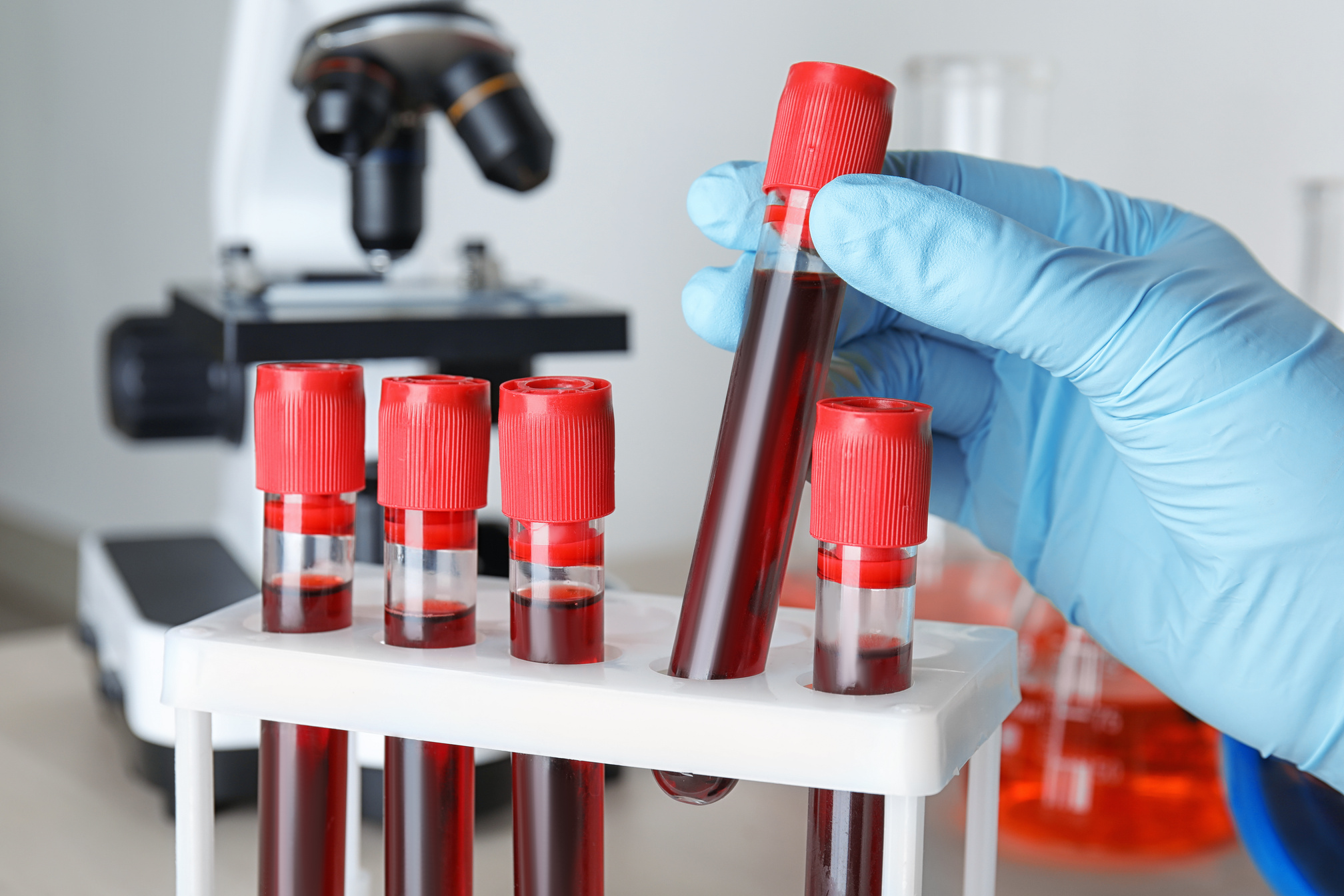 Scientist Taking Test Tube with Blood Sample from Rack at Table, Closeup. Laboratory Analysis